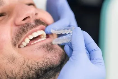 patient getting fitted for clear orthodontic aligners